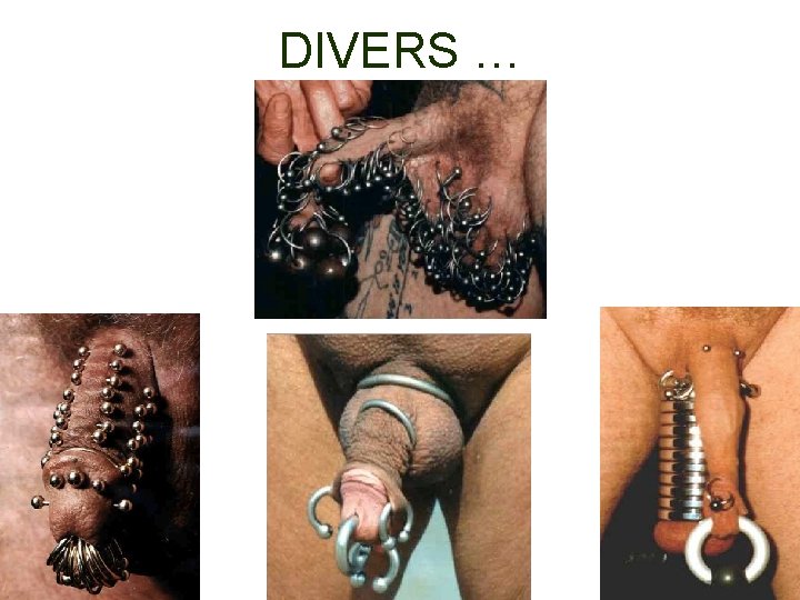 DIVERS … 
