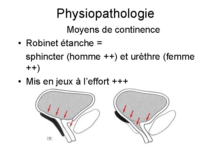 Physiopathologie Moyens de continence • Robinet étanche = sphincter (homme ++) et urèthre (femme