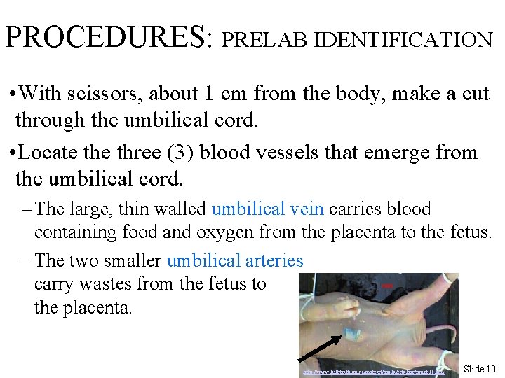 PROCEDURES: PRELAB IDENTIFICATION • With scissors, about 1 cm from the body, make a