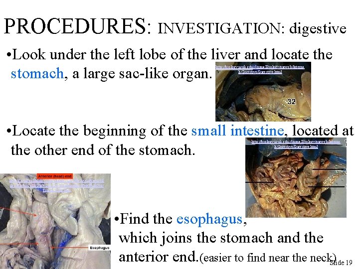 PROCEDURES: INVESTIGATION: digestive • Look under the left lobe of the liver and locate