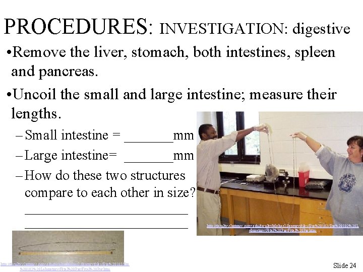 PROCEDURES: INVESTIGATION: digestive • Remove the liver, stomach, both intestines, spleen and pancreas. •