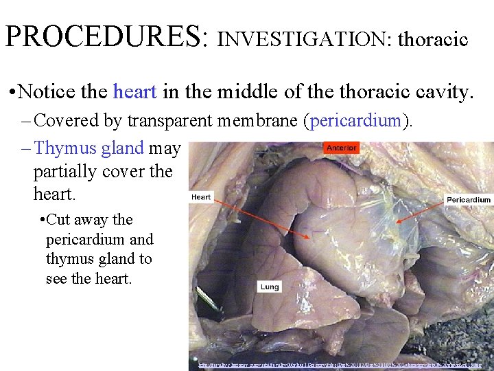 PROCEDURES: INVESTIGATION: thoracic • Notice the heart in the middle of the thoracic cavity.