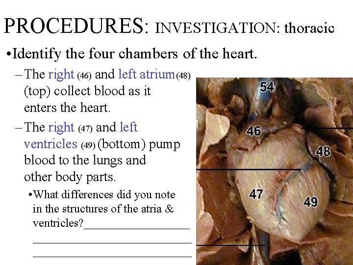 PROCEDURES: INVESTIGATION: thoracic • Identify the four chambers of the heart. – The right