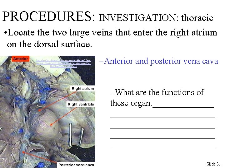 PROCEDURES: INVESTIGATION: thoracic • Locate the two large veins that enter the right atrium