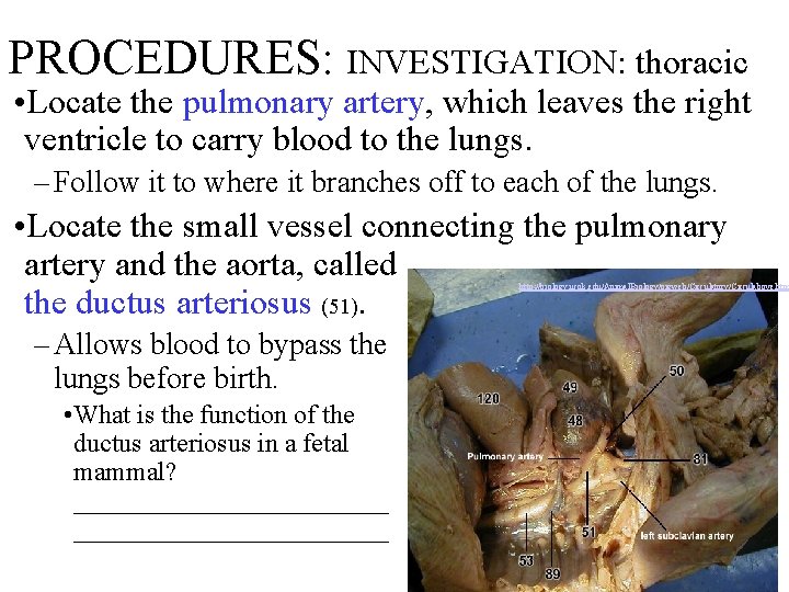 PROCEDURES: INVESTIGATION: thoracic • Locate the pulmonary artery, which leaves the right ventricle to