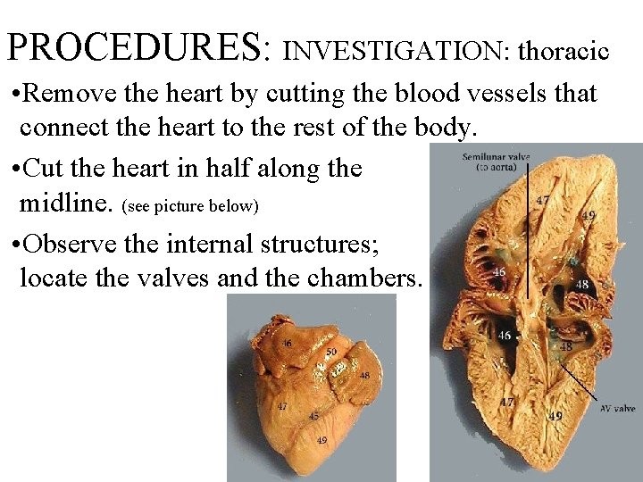 PROCEDURES: INVESTIGATION: thoracic • Remove the heart by cutting the blood vessels that connect