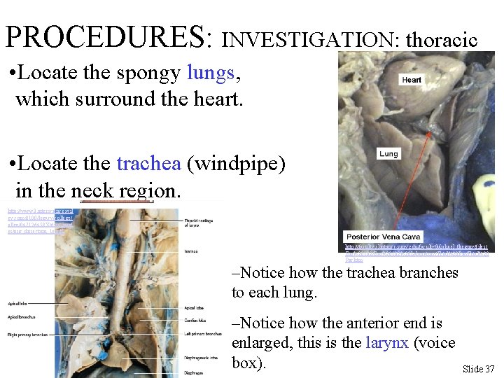PROCEDURES: INVESTIGATION: thoracic • Locate the spongy lungs, which surround the heart. • Locate