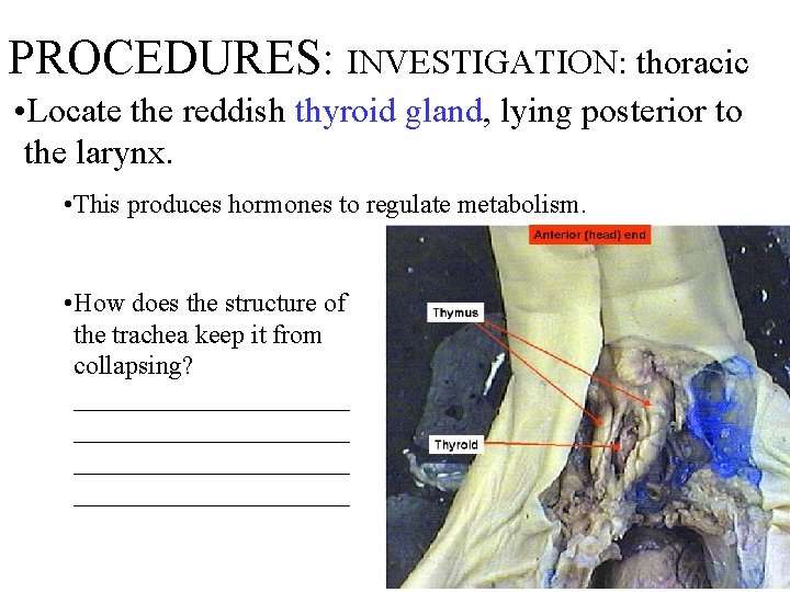 PROCEDURES: INVESTIGATION: thoracic • Locate the reddish thyroid gland, lying posterior to the larynx.