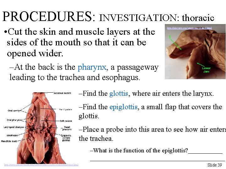 PROCEDURES: INVESTIGATION: thoracic • Cut the skin and muscle layers at the sides of