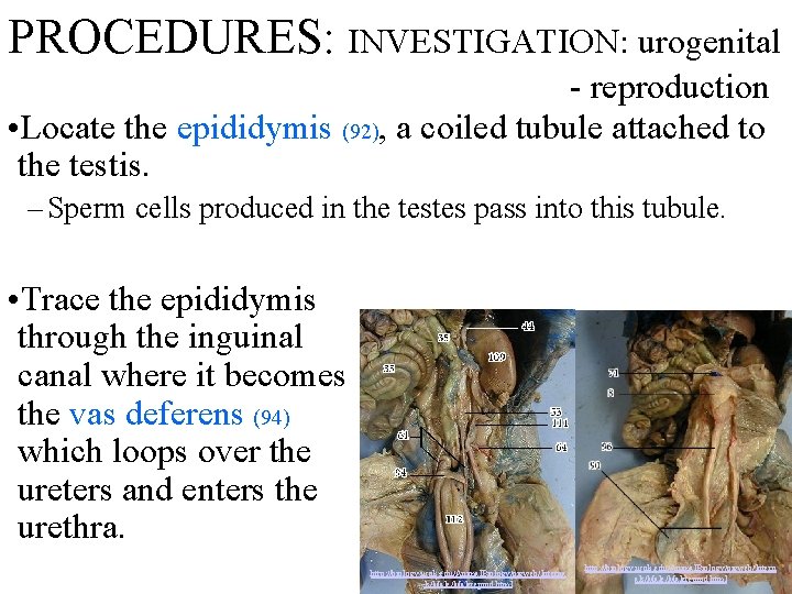 PROCEDURES: INVESTIGATION: urogenital - reproduction • Locate the epididymis (92), a coiled tubule attached