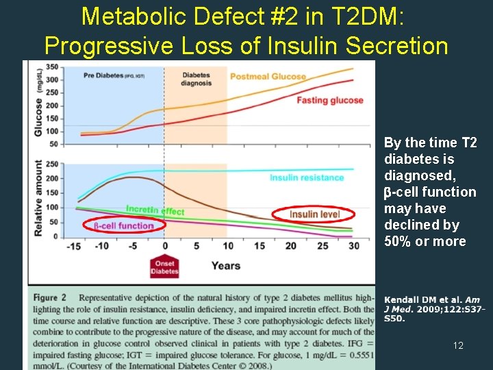 Metabolic Defect #2 in T 2 DM: Progressive Loss of Insulin Secretion By the