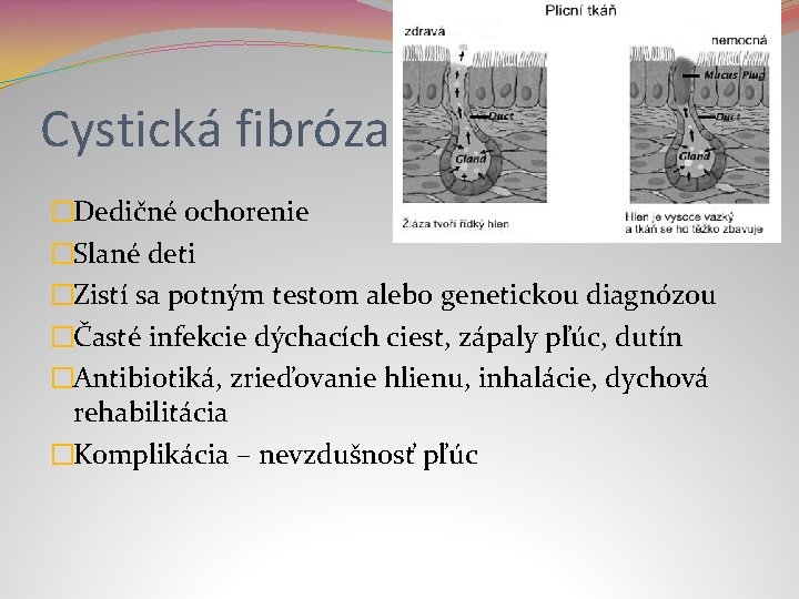 Cystická fibróza �Dedičné ochorenie �Slané deti �Zistí sa potným testom alebo genetickou diagnózou �Časté