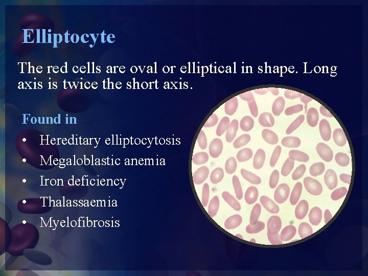 Elliptocyte The red cells are oval or elliptical in shape. Long axis is twice
