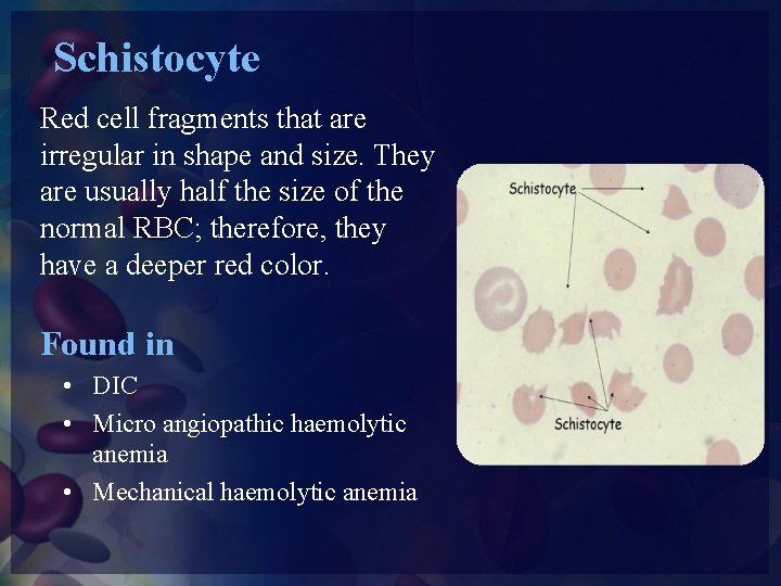 Schistocyte Red cell fragments that are irregular in shape and size. They are usually