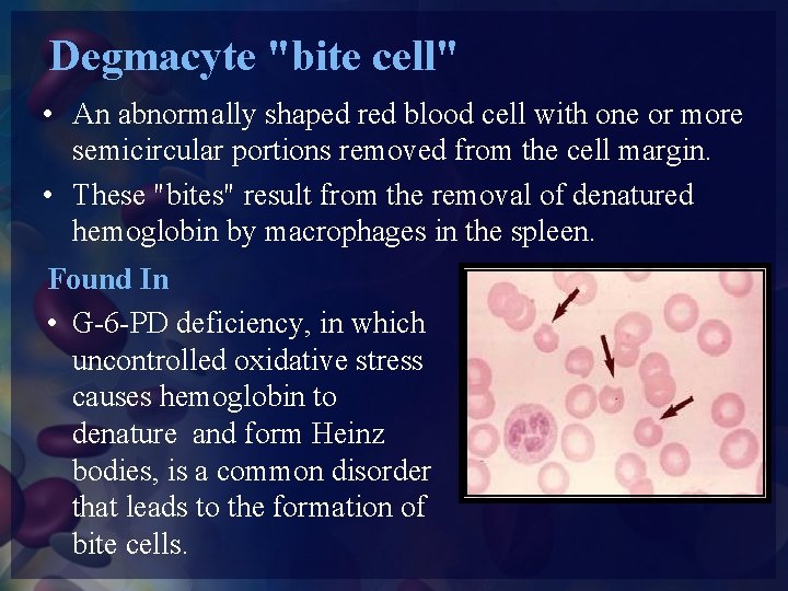 Degmacyte "bite cell" • An abnormally shaped red blood cell with one or more