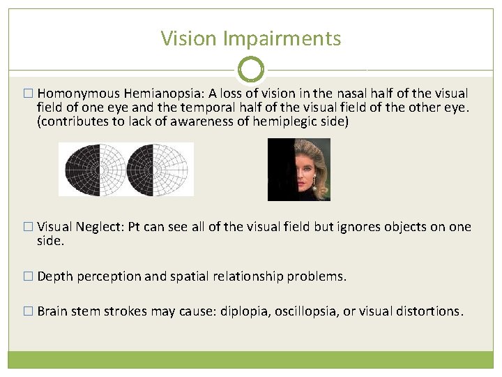 Vision Impairments � Homonymous Hemianopsia: A loss of vision in the nasal half of