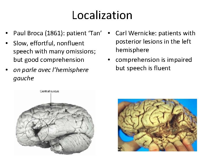 Localization • Paul Broca (1861): patient ‘Tan’ • Carl Wernicke: patients with posterior lesions