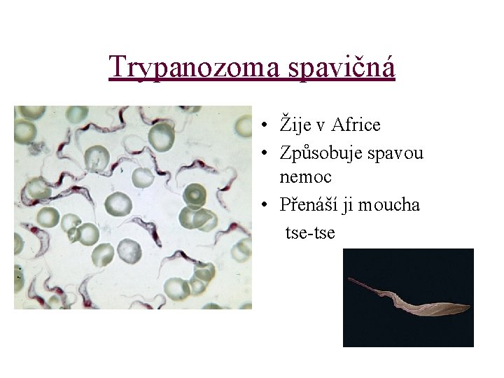 Trypanozoma spavičná • Žije v Africe • Způsobuje spavou nemoc • Přenáší ji moucha