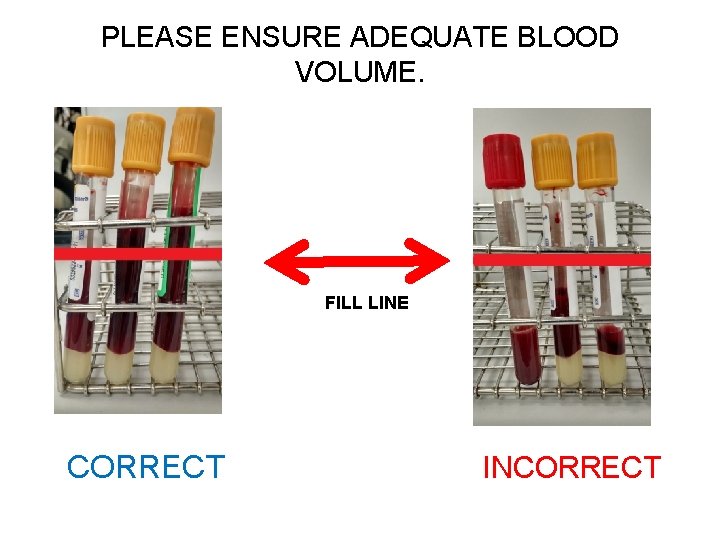 PLEASE ENSURE ADEQUATE BLOOD VOLUME. FILL LINE CORRECT INCORRECT PLEASE ENSURE ADEQUATE BLOOD VOLUME. FILL LINE CORRECT INCORRECT