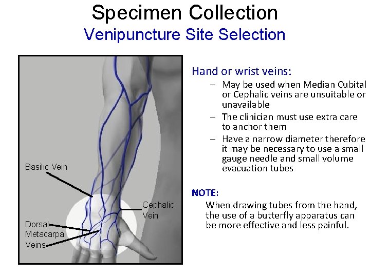 Specimen Collection Venipuncture Site Selection Hand or wrist veins: – May be used when Specimen Collection Venipuncture Site Selection Hand or wrist veins: – May be used when