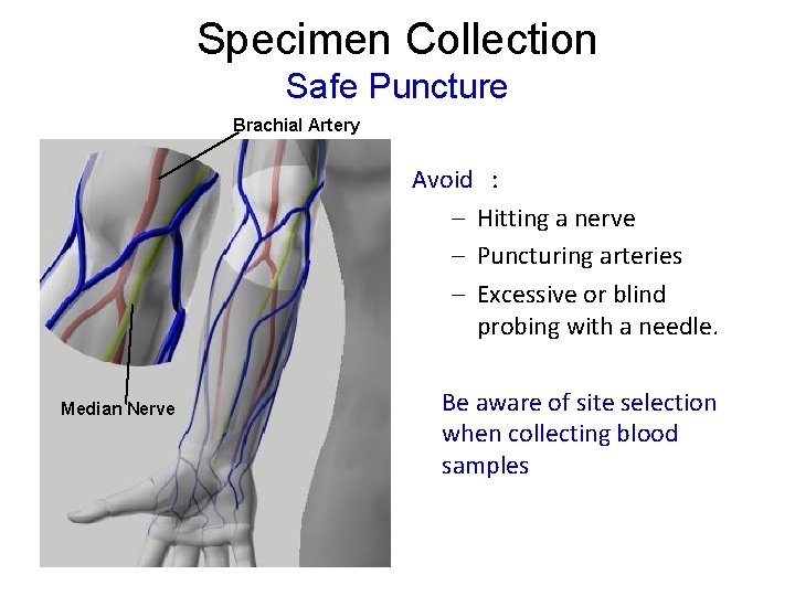 Specimen Collection Safe Puncture Brachial Artery Avoid : – Hitting a nerve – Puncturing Specimen Collection Safe Puncture Brachial Artery Avoid : – Hitting a nerve – Puncturing