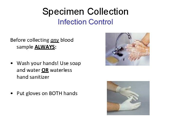 Specimen Collection Infection Control Before collecting any blood sample ALWAYS: • Wash your hands! Specimen Collection Infection Control Before collecting any blood sample ALWAYS: • Wash your hands!