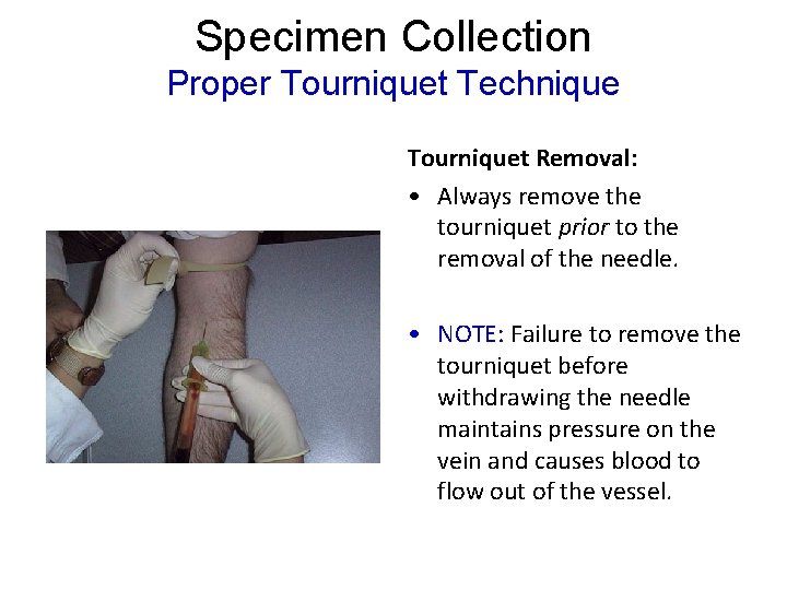 Specimen Collection Proper Tourniquet Technique Tourniquet Removal: • Always remove the tourniquet prior to Specimen Collection Proper Tourniquet Technique Tourniquet Removal: • Always remove the tourniquet prior to