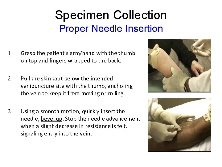 Specimen Collection Proper Needle Insertion 1. Grasp the patient's arm/hand with the thumb on Specimen Collection Proper Needle Insertion 1. Grasp the patient's arm/hand with the thumb on