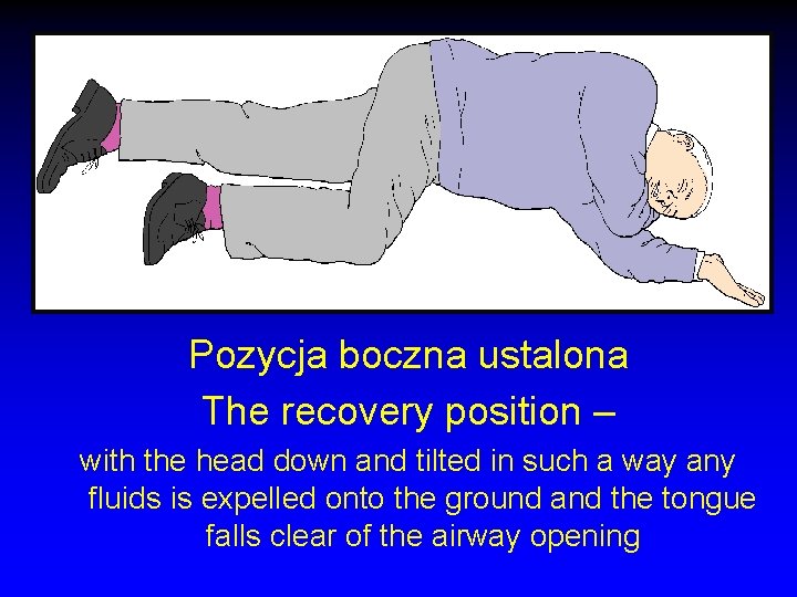 Pozycja boczna ustalona The recovery position – with the head down and tilted in