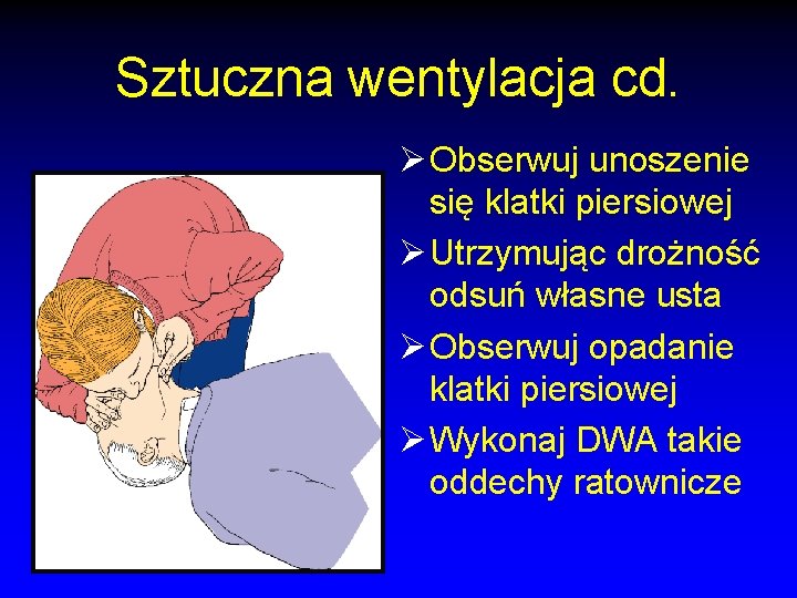 Sztuczna wentylacja cd. Ø Obserwuj unoszenie się klatki piersiowej Ø Utrzymując drożność odsuń własne