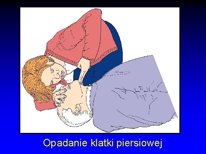 Opadanie klatki piersiowej 