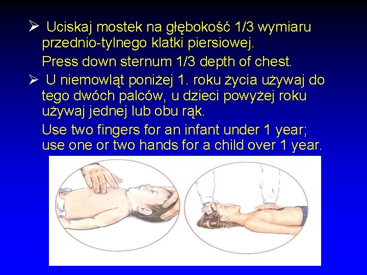 Ø Uciskaj mostek na głębokość 1/3 wymiaru przednio-tylnego klatki piersiowej. Press down sternum 1/3