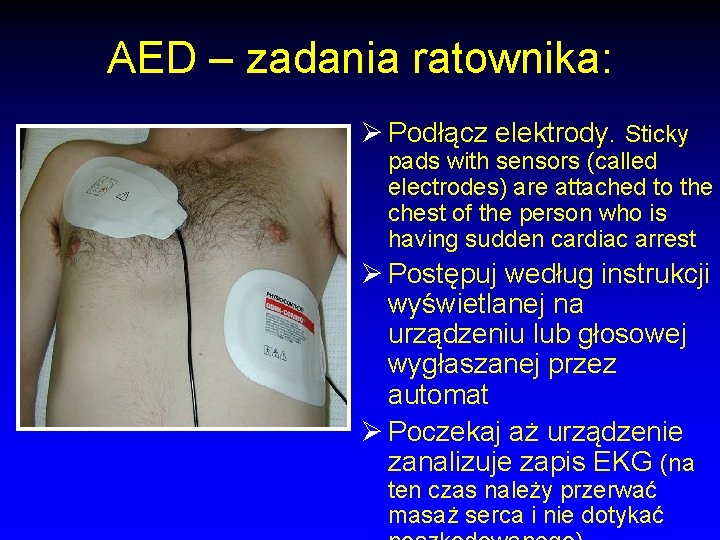 AED – zadania ratownika: Ø Podłącz elektrody. Sticky pads with sensors (called electrodes) are