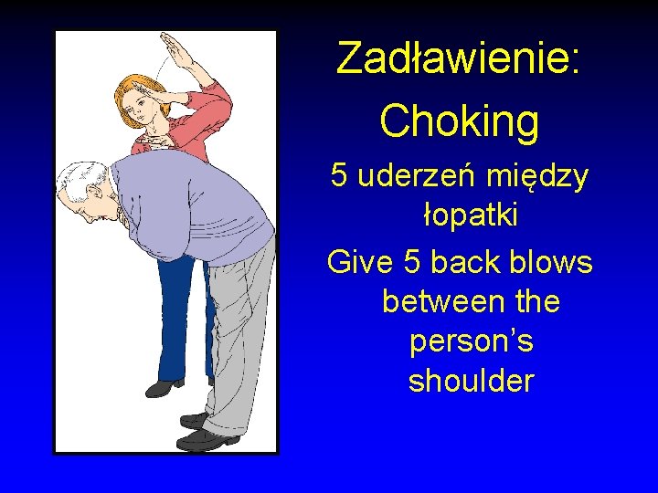 Zadławienie: Choking 5 uderzeń między łopatki Give 5 back blows between the person’s shoulder