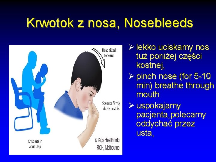 Krwotok z nosa, Nosebleeds Ø lekko uciskamy nos tuż poniżej części kostnej, Ø pinch