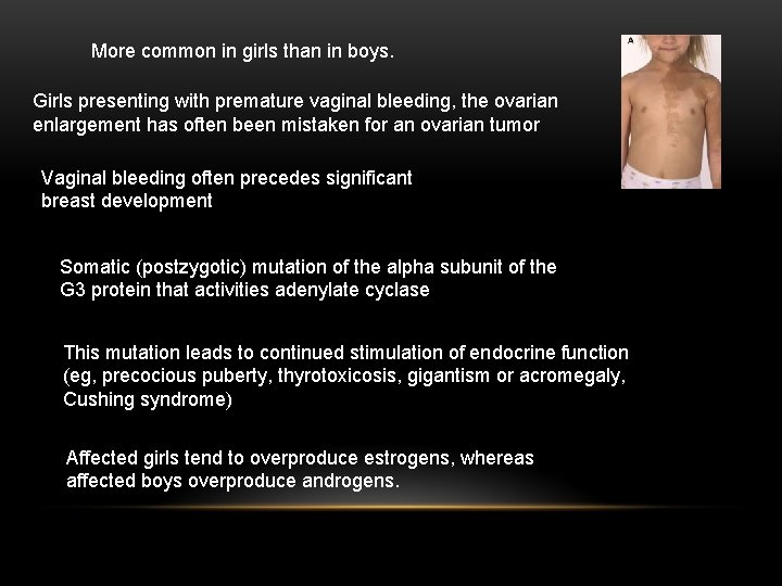 More common in girls than in boys. Girls presenting with premature vaginal bleeding, the