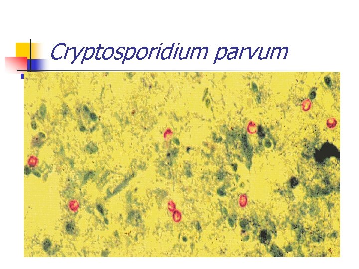 Cryptosporidium parvum 