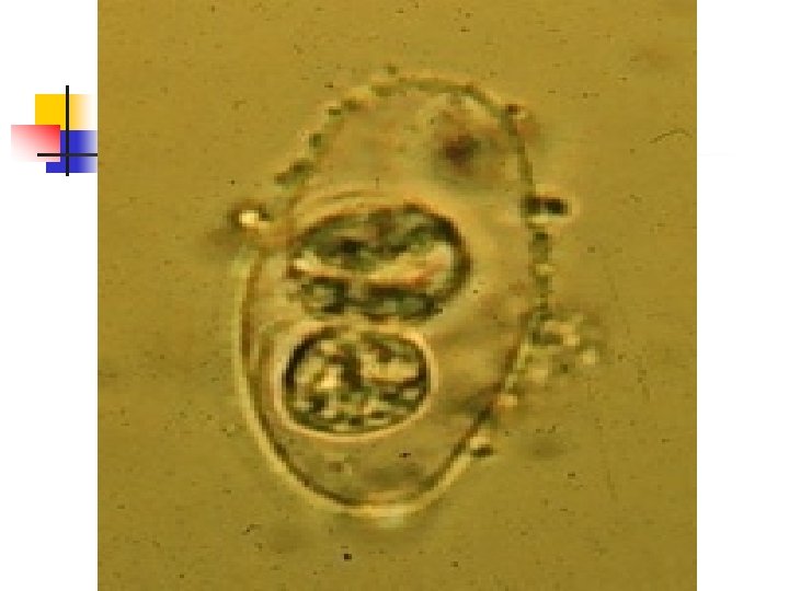 Oocysts of Isospora bel 