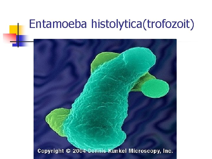 Entamoeba histolytica(trofozoit) 