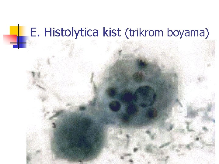 E. Histolytica kist (trikrom boyama) 