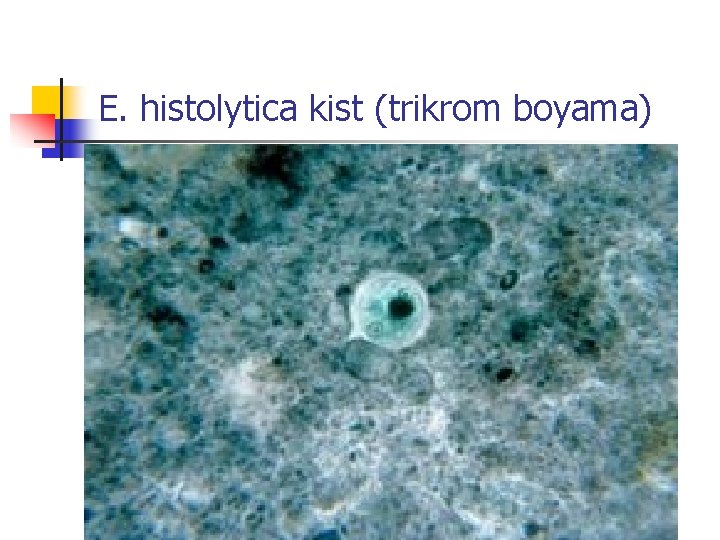 E. histolytica kist (trikrom boyama) 