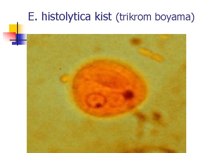 E. histolytica kist (trikrom boyama) 