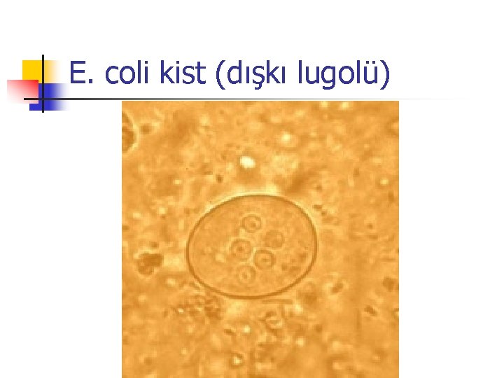 E. coli kist (dışkı lugolü) 