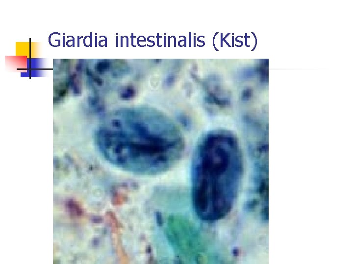 Giardia intestinalis (Kist) 