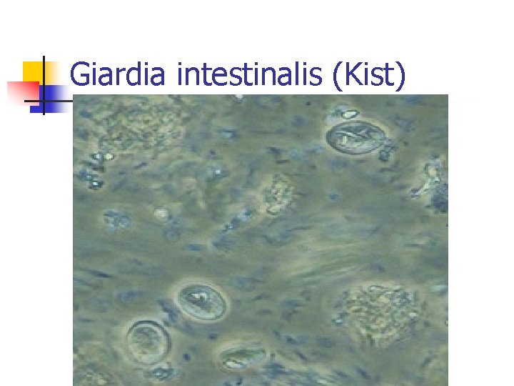 Giardia intestinalis (Kist) 