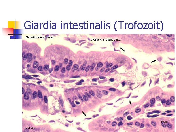 Giardia intestinalis (Trofozoit) 