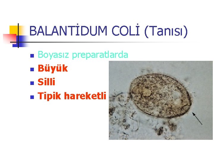 BALANTİDUM COLİ (Tanısı) n n Boyasız preparatlarda Büyük Silli Tipik hareketli 