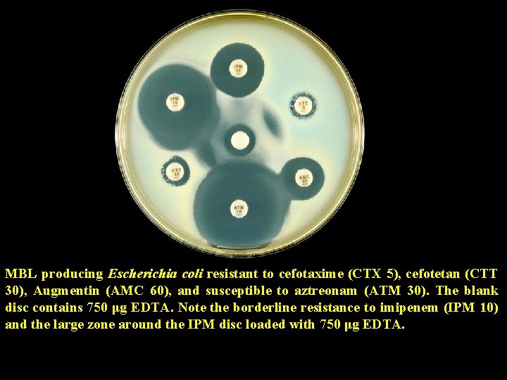 MBL producing Escherichia coli resistant to cefotaxime (CTX 5), cefotetan (CTT 30), Augmentin (AMC