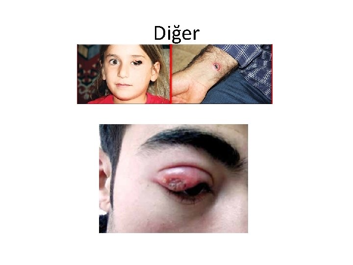 Diğer 