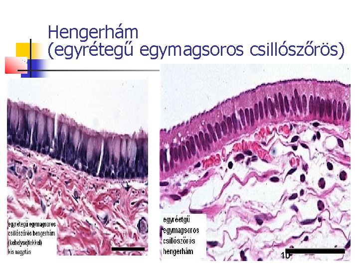 Hengerhám (egyrétegű egymagsoros csillószőrös) 10 